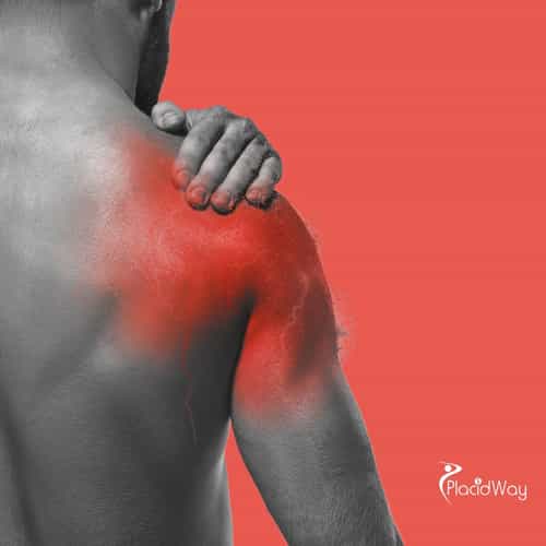 Restoring Shoulder Mobility: A Berlin Patient’s Guide to Stem Cell Therapy in Greece